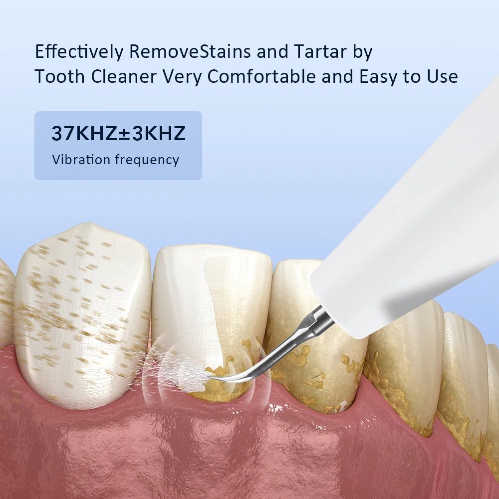 Electric Ultrasonic Teeth Tartar Cleaner Dental Scaler Tool for Oral Care Teeth Whitening Stain & Plaque Removal